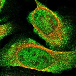 KRBA2 Antibody, Novus Biologicals:Antibodies:Primary Antibodies